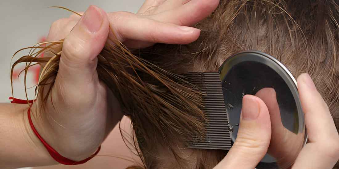 Dealing with Head Lice: Prevention and Treatment